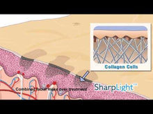 Cargar y reproducir el video en el visor de la galería, Recarga contador de IPL Sharplight Beamax